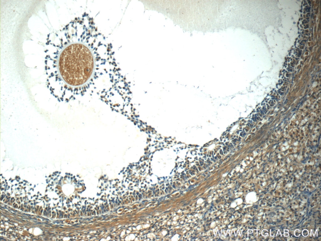IHC staining of human ovary using 25233-1-AP