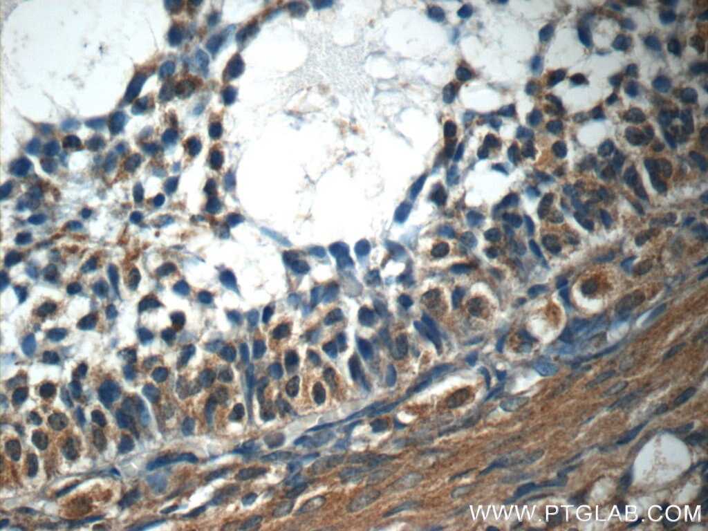 Immunohistochemistry (IHC) staining of human ovary tissue using MARF1 Polyclonal antibody (25233-1-AP)