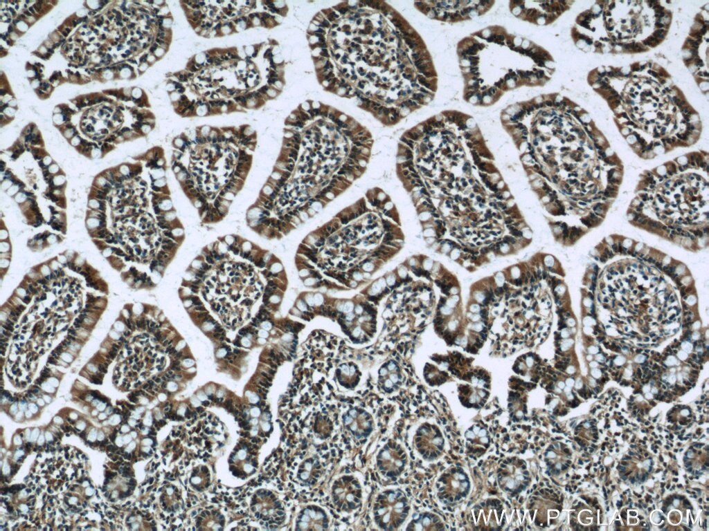 Immunohistochemistry (IHC) staining of human small intestine tissue using MARF1 Polyclonal antibody (25233-1-AP)
