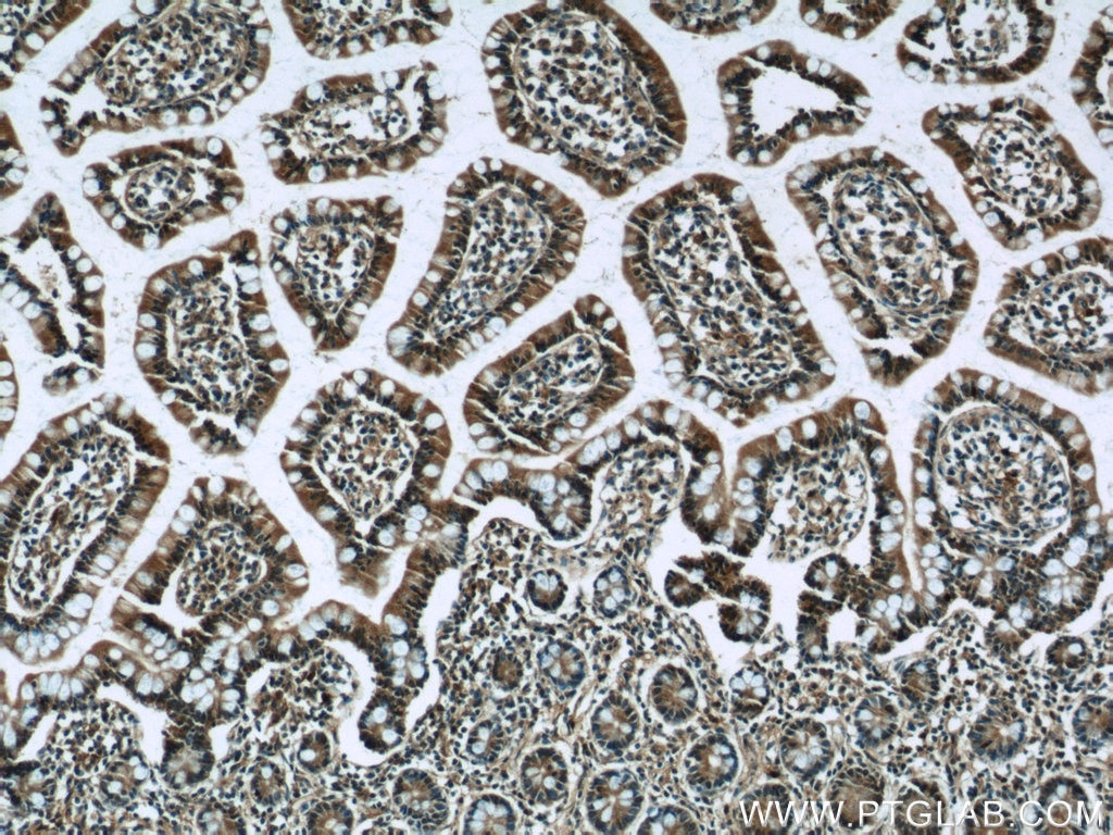 IHC staining of human small intestine using 25233-1-AP