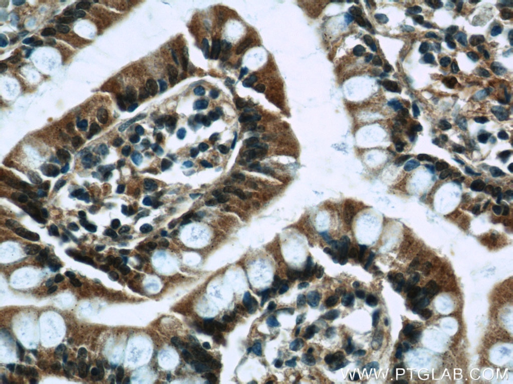 Immunohistochemistry (IHC) staining of human small intestine tissue using MARF1 Polyclonal antibody (25233-1-AP)