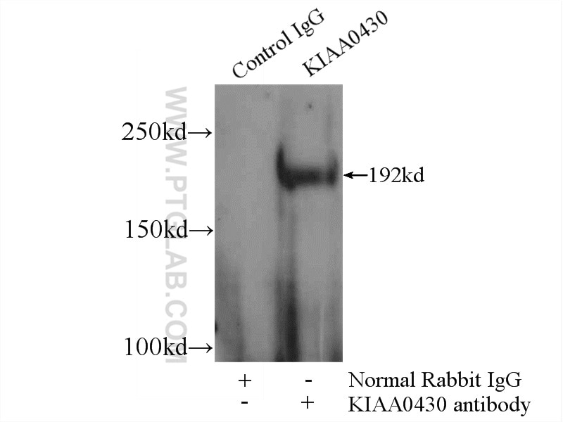 Immunoprecipitation (IP) experiment of HeLa cells using MARF1 Polyclonal antibody (25233-1-AP)