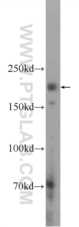 Western Blot (WB) analysis of HEK-293 cells using MARF1 Polyclonal antibody (25233-1-AP)