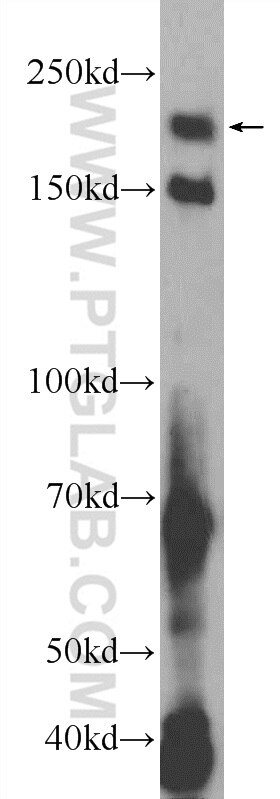 Western Blot (WB) analysis of HeLa cells using MARF1 Polyclonal antibody (25233-1-AP)
