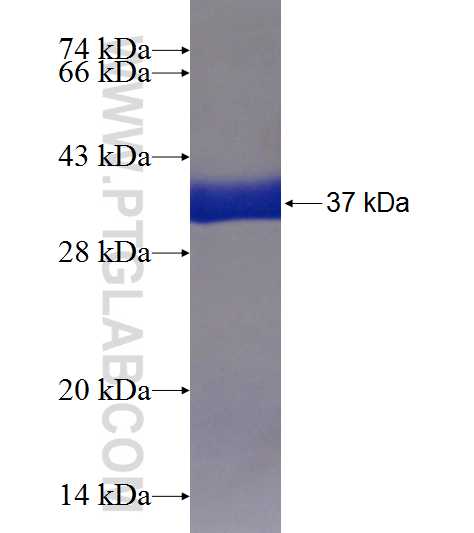 KIAA0430 fusion protein Ag18905 SDS-PAGE