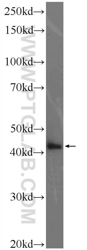 WB analysis of SMMC-7721 using 19569-1-AP