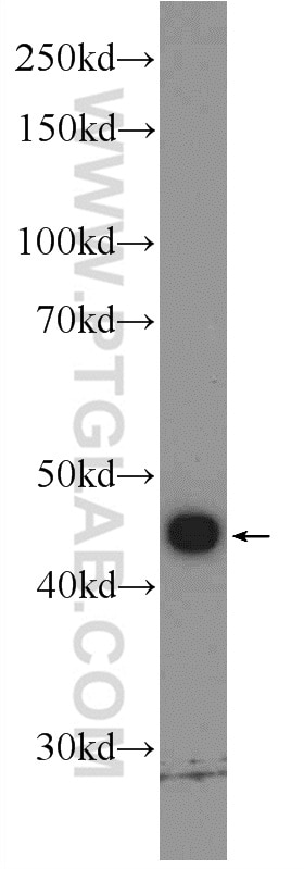 Western Blot (WB) analysis of HeLa cells using KIAA0494 Polyclonal antibody (19569-1-AP)