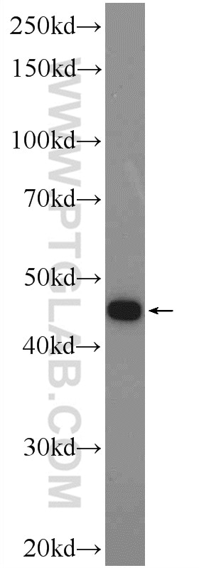 Western Blot (WB) analysis of K-562 cells using KIAA0494 Polyclonal antibody (19569-1-AP)