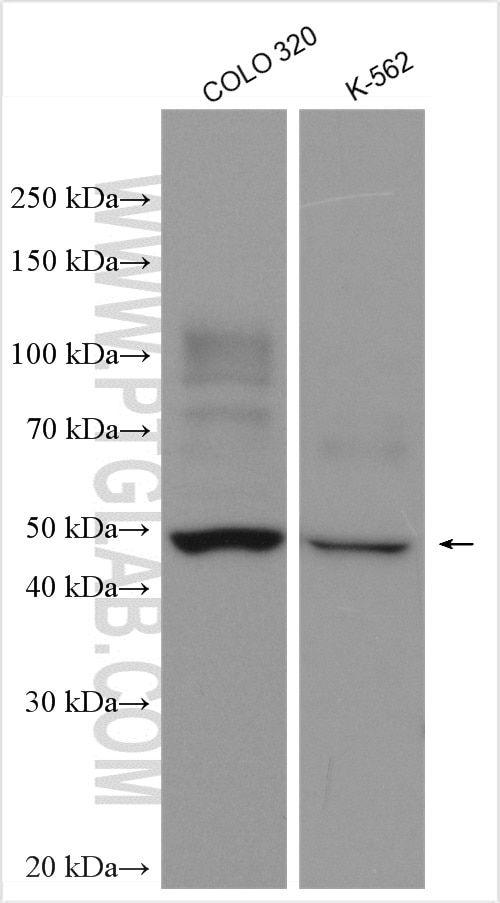 Western Blot (WB) analysis of various lysates using KIAA0494 Polyclonal antibody (19569-1-AP)