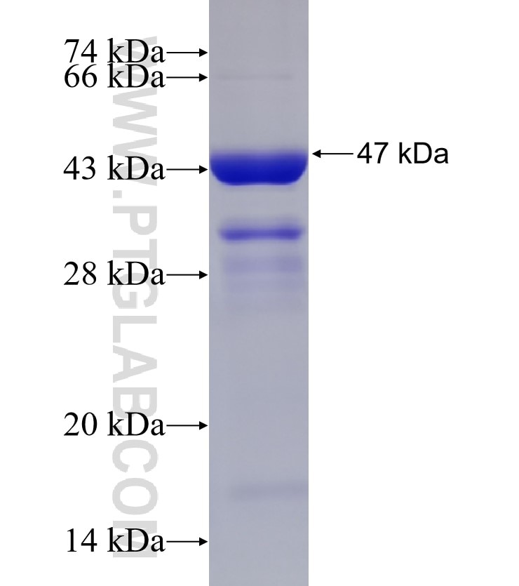 KIAA0494 fusion protein Ag33197 SDS-PAGE