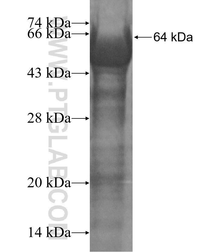 KIAA0494 fusion protein Ag13757 SDS-PAGE