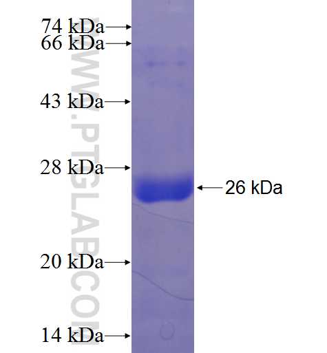 KIAA0495 fusion protein Ag23741 SDS-PAGE