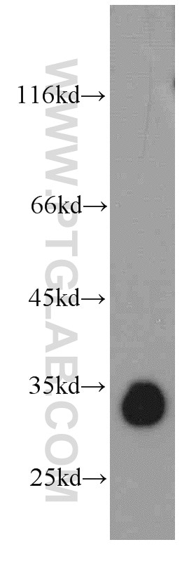 Western Blot (WB) analysis of mouse brain tissue using KIAA0513 Polyclonal antibody (21478-1-AP)