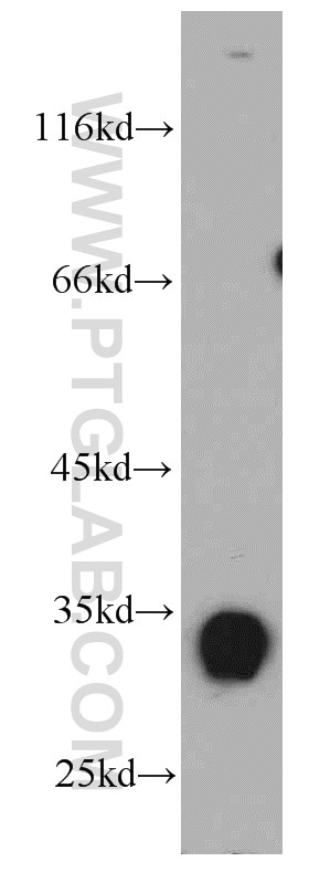 WB analysis of mouse kidney using 21478-1-AP