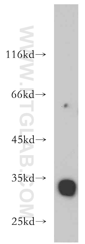 WB analysis of human testis using 21478-1-AP