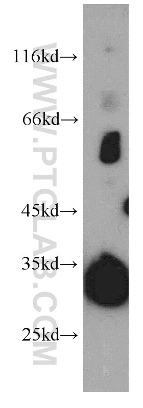 WB analysis of mouse cerebellum using 21478-1-AP