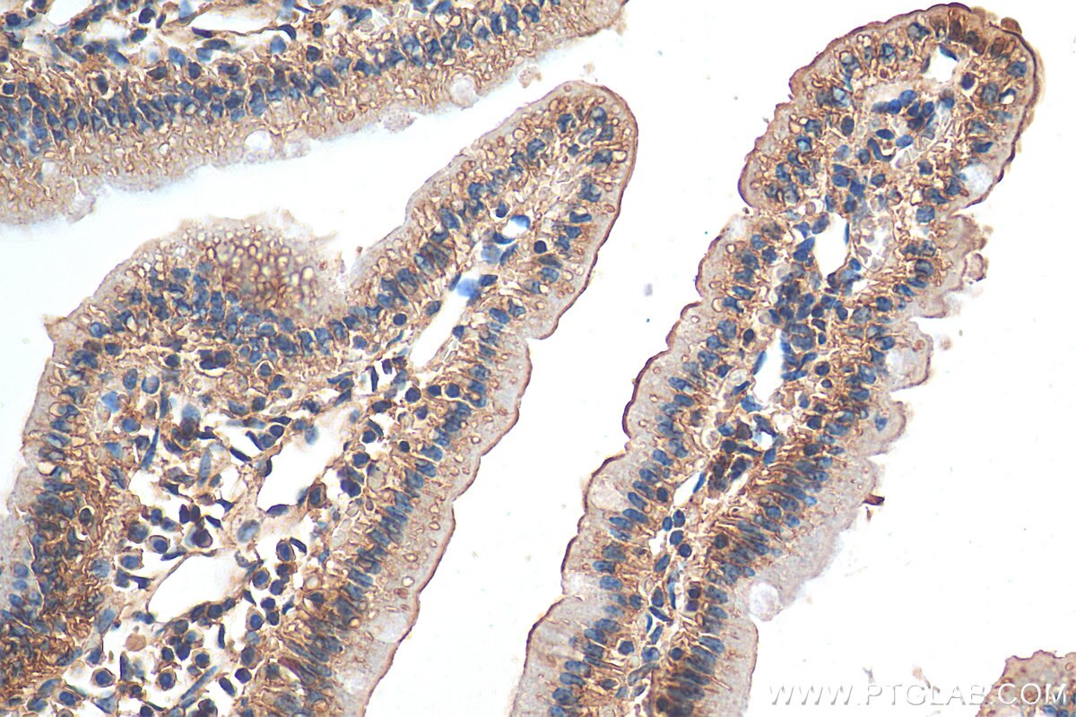 Immunohistochemistry (IHC) staining of mouse small intestine tissue using KIAA0528 Polyclonal antibody (21138-1-AP)