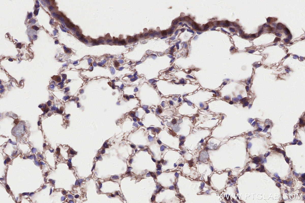 Immunohistochemistry (IHC) staining of mouse lung tissue using KIAA0528 Polyclonal antibody (21138-1-AP)