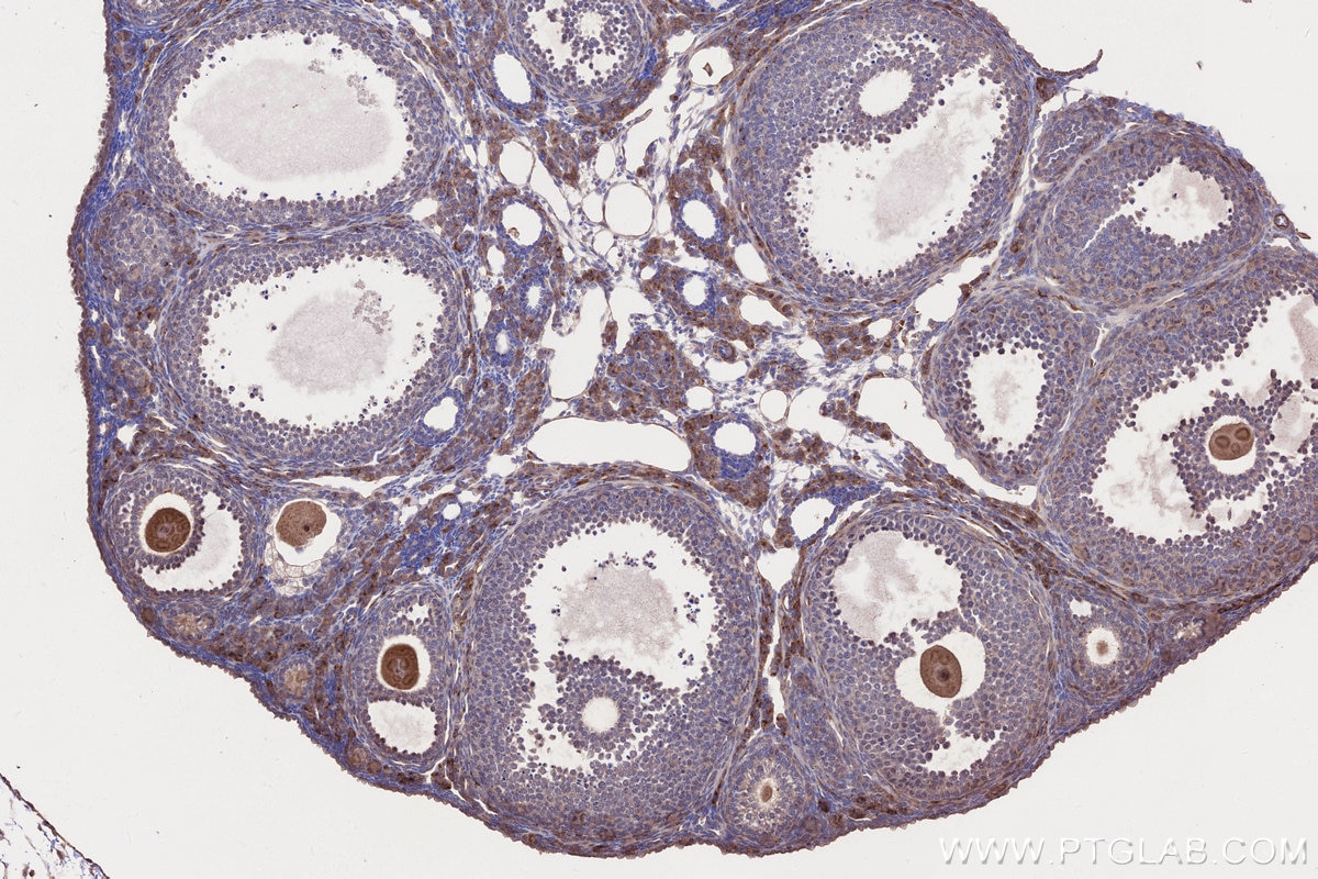 Immunohistochemistry (IHC) staining of mouse ovary tissue using KIAA0528 Polyclonal antibody (21138-1-AP)