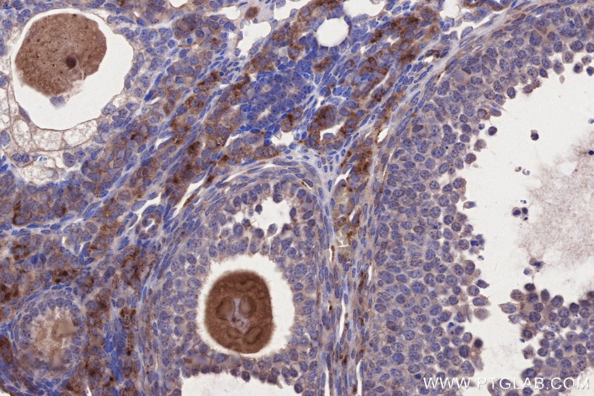 Immunohistochemistry (IHC) staining of mouse ovary tissue using KIAA0528 Polyclonal antibody (21138-1-AP)