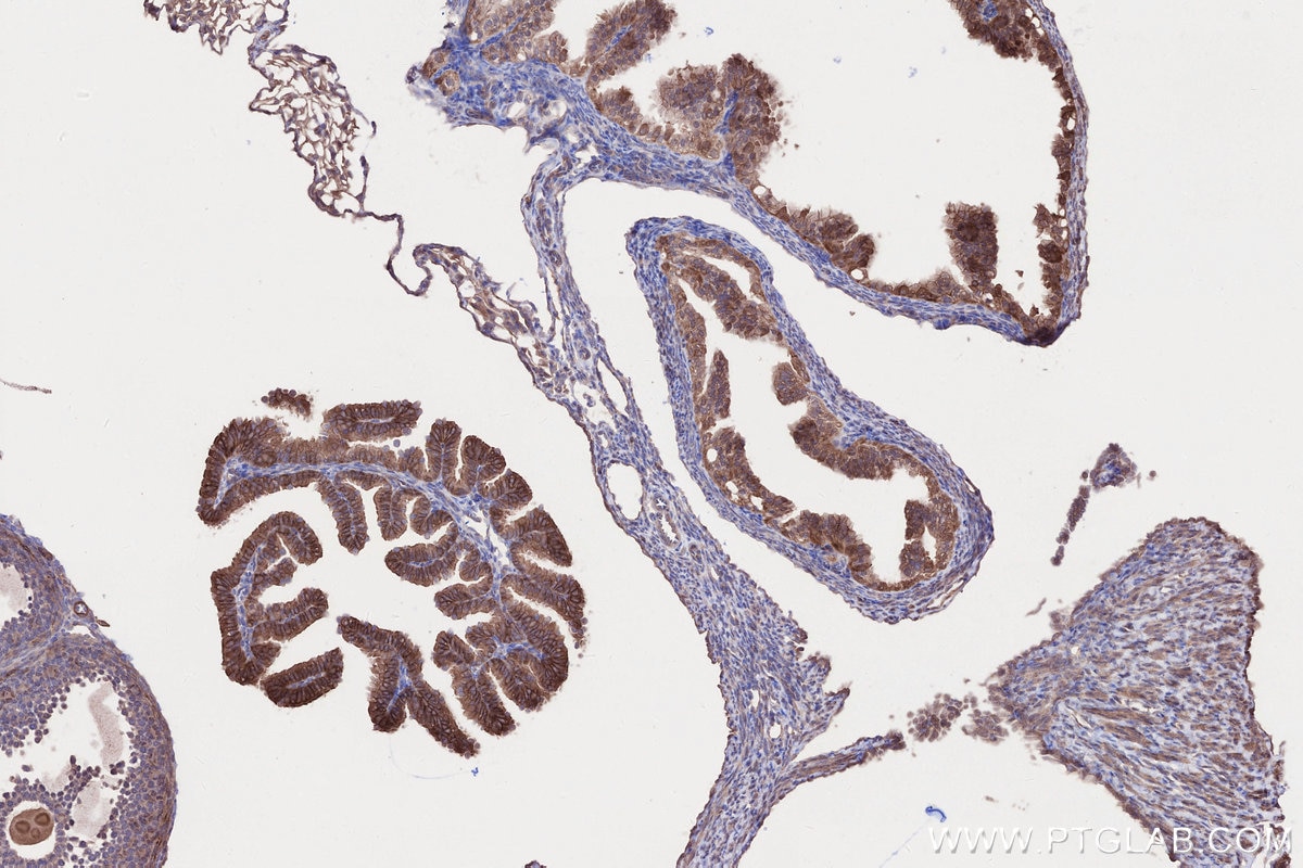 Immunohistochemistry (IHC) staining of mouse ovary tissue using KIAA0528 Polyclonal antibody (21138-1-AP)