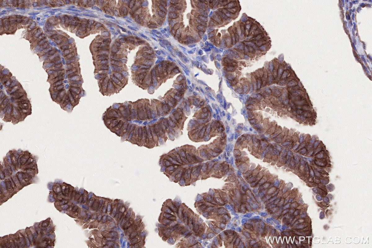 Immunohistochemistry (IHC) staining of mouse ovary tissue using KIAA0528 Polyclonal antibody (21138-1-AP)