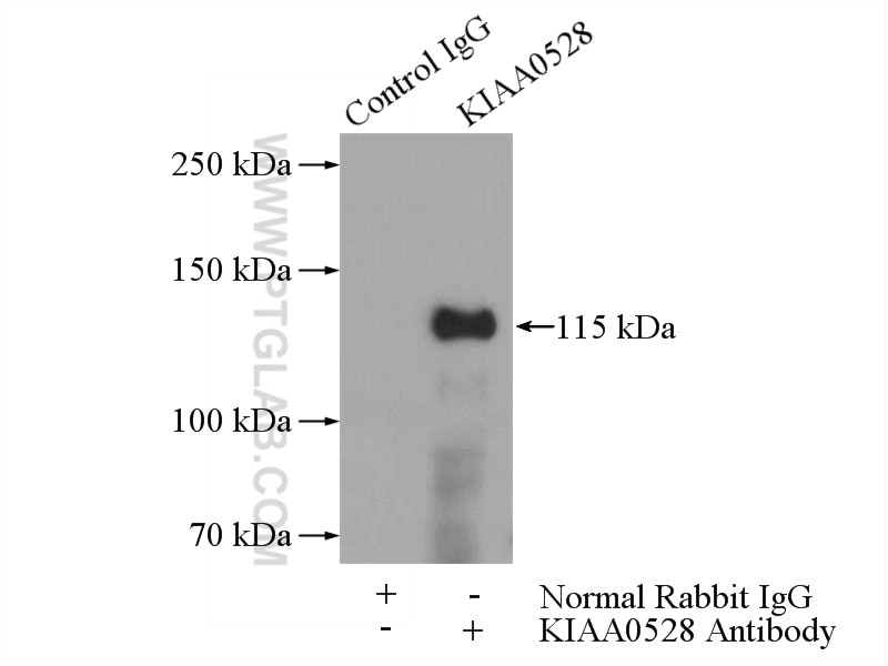 Immunoprecipitation (IP) experiment of HeLa cells using KIAA0528 Polyclonal antibody (21138-1-AP)