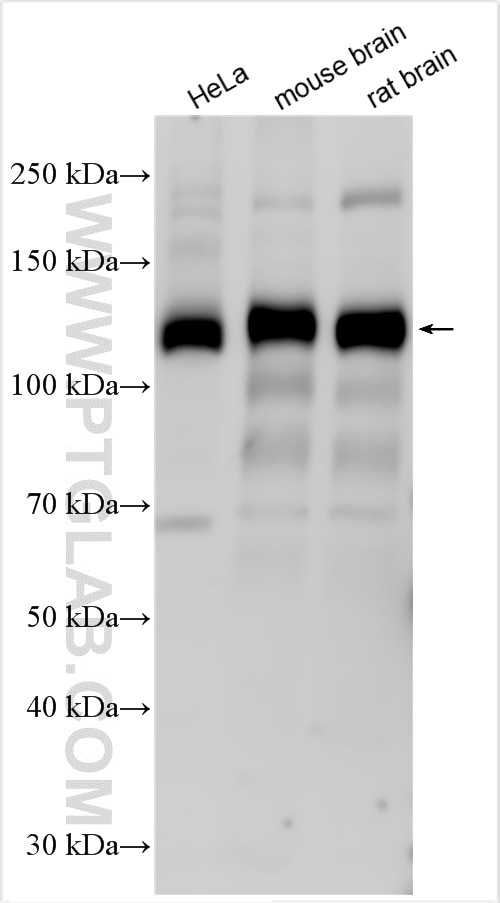 Western Blot (WB) analysis of various lysates using KIAA0528 Polyclonal antibody (21138-1-AP)