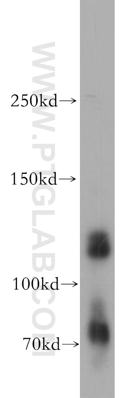 Western Blot (WB) analysis of HeLa cells using KIAA0528 Polyclonal antibody (21138-1-AP)