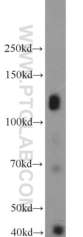 Western Blot (WB) analysis of HeLa cells using KIAA0528 Polyclonal antibody (21138-1-AP)