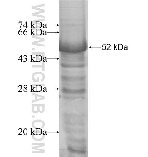 KIAA0528 fusion protein Ag15769 SDS-PAGE
