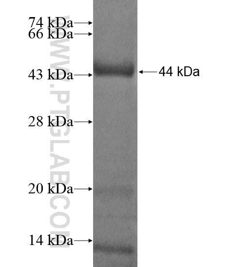 KIAA0556 fusion protein Ag20260 SDS-PAGE