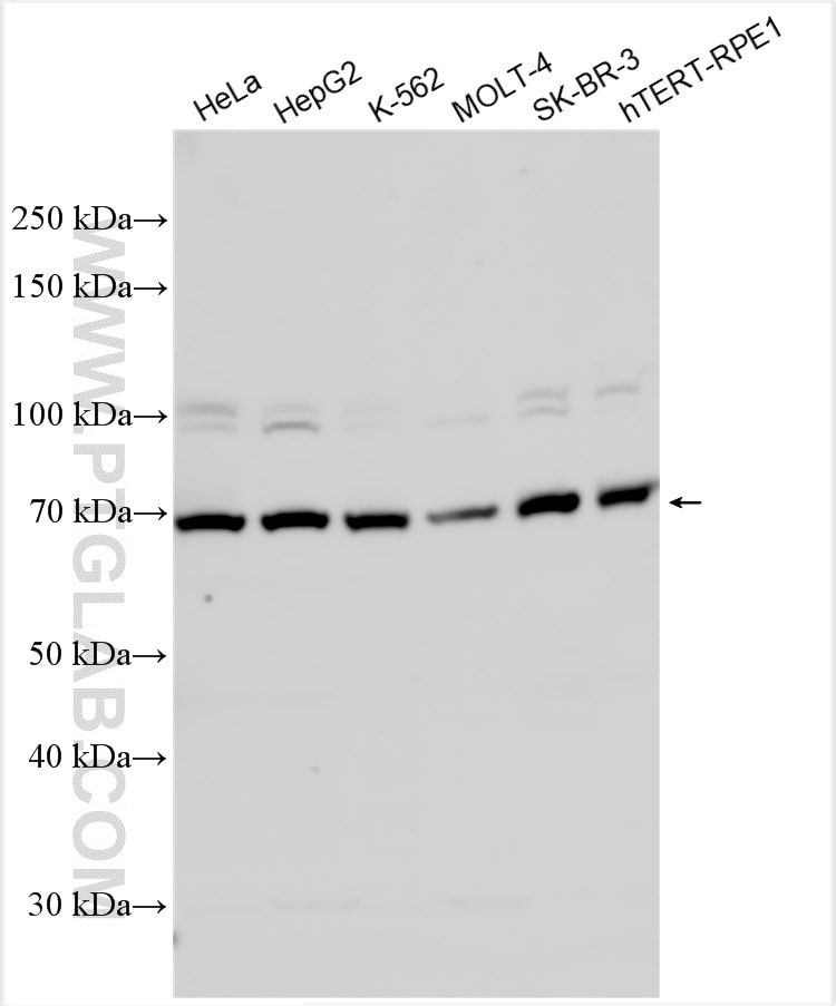 Western Blot (WB) analysis of various lysates using KIAA0562 Polyclonal antibody (31847-1-AP)