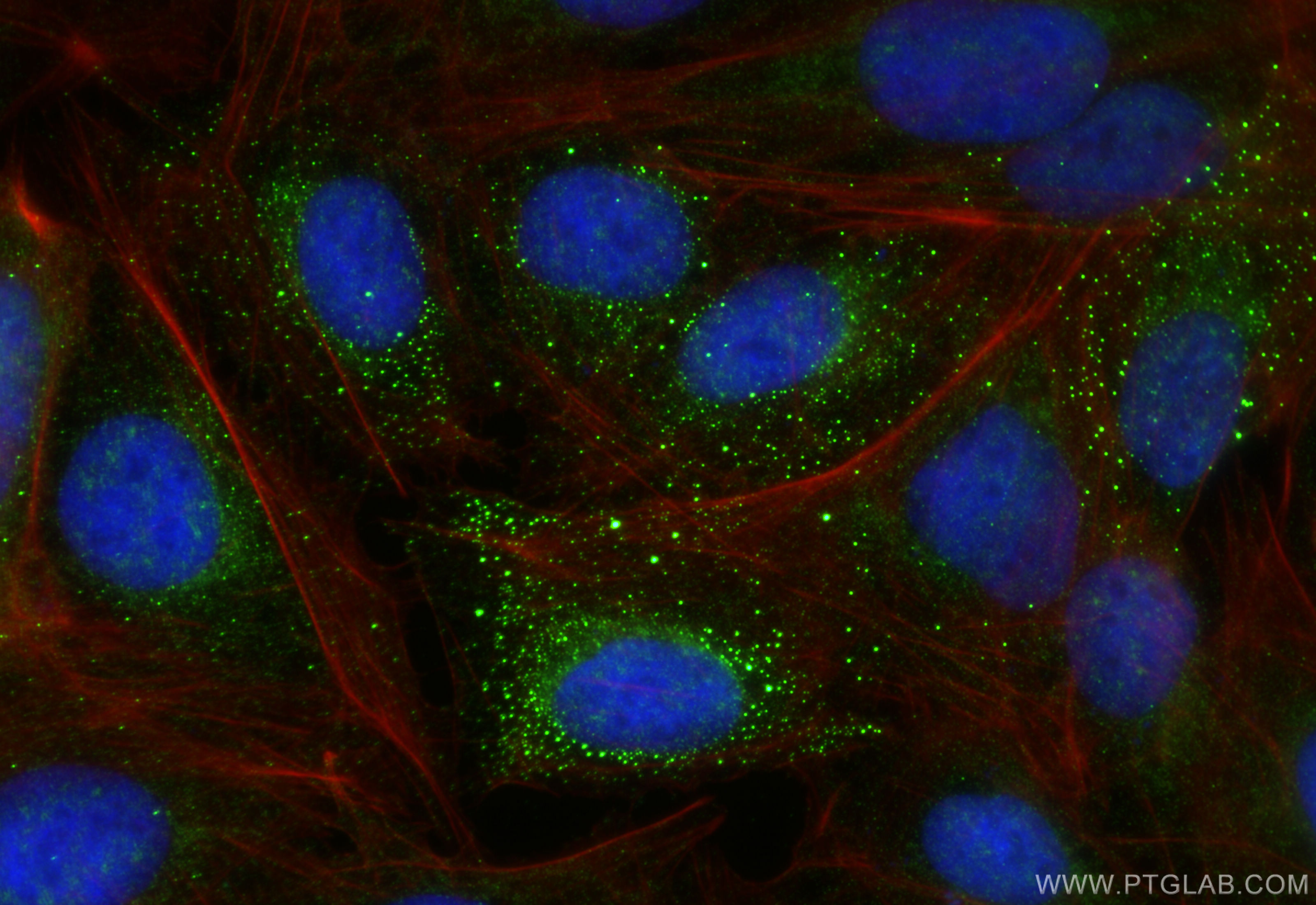 Immunofluorescence (IF) / fluorescent staining of U2OS cells using VWA8 Polyclonal antibody (31348-1-AP)