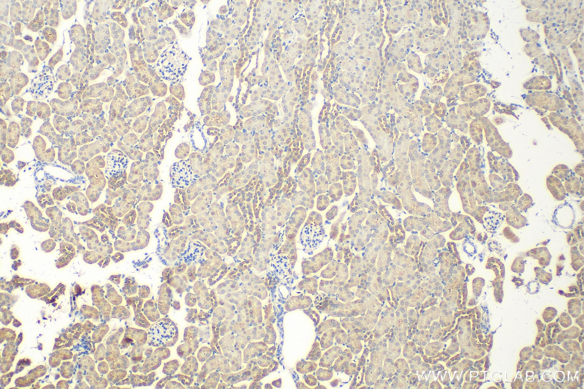 Immunohistochemistry (IHC) staining of mouse kidney tissue using VWA8 Polyclonal antibody (31348-1-AP)