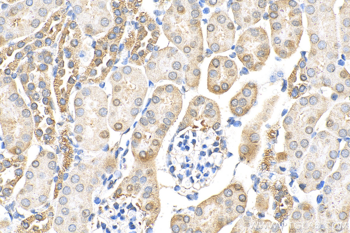 Immunohistochemistry (IHC) staining of mouse kidney tissue using VWA8 Polyclonal antibody (31348-1-AP)