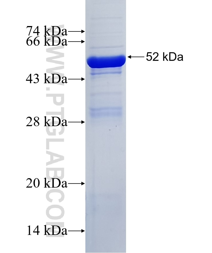 KIAA0564 fusion protein Ag35404 SDS-PAGE
