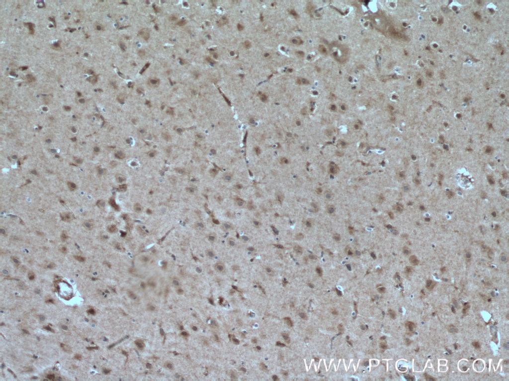 Immunohistochemistry (IHC) staining of human brain tissue using TALPID3 Polyclonal antibody (24421-1-AP)