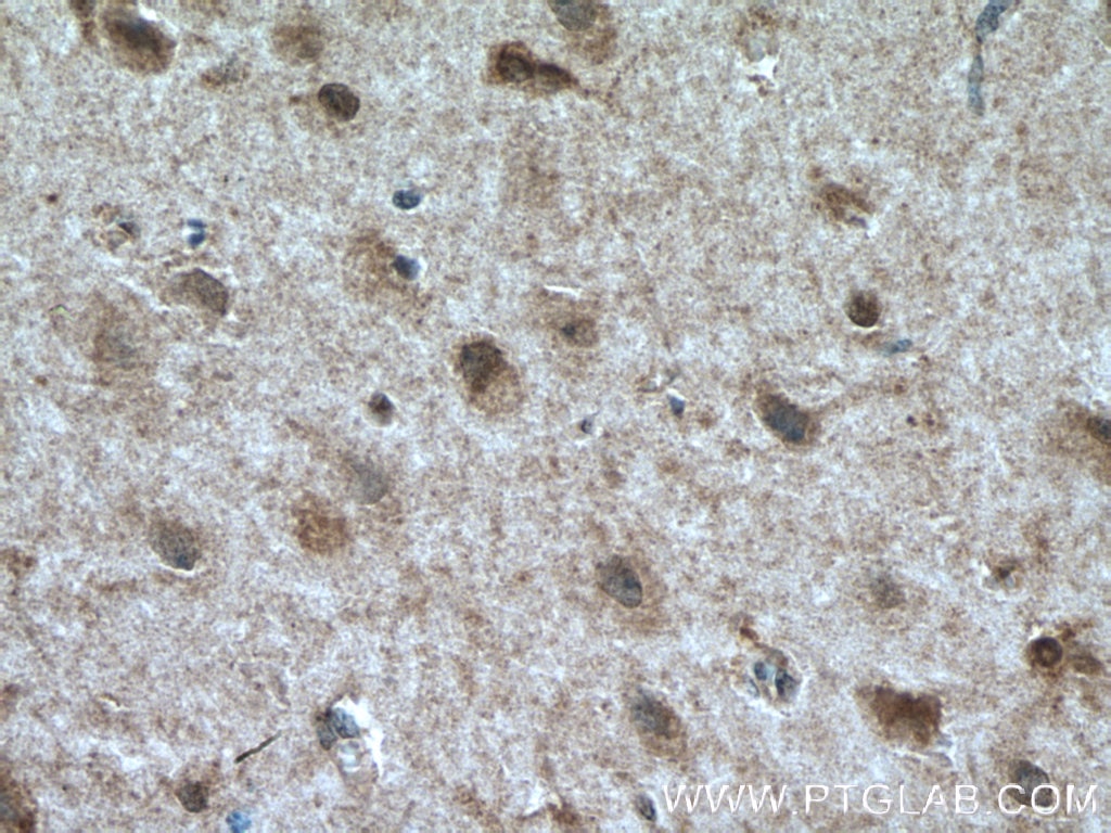 Immunohistochemistry (IHC) staining of human brain tissue using TALPID3 Polyclonal antibody (24421-1-AP)