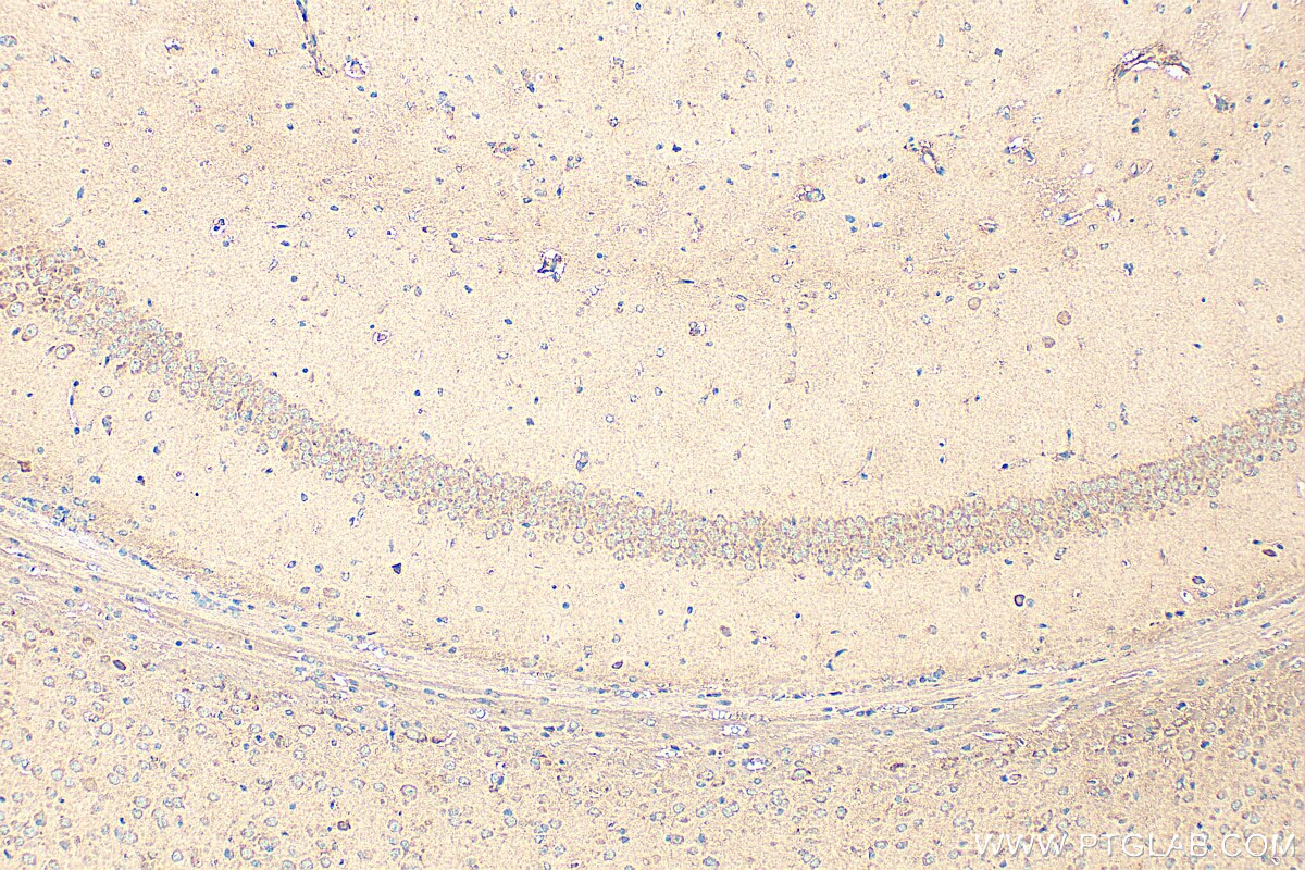 Immunohistochemistry (IHC) staining of mouse brain tissue using TALPID3 Polyclonal antibody (24421-1-AP)