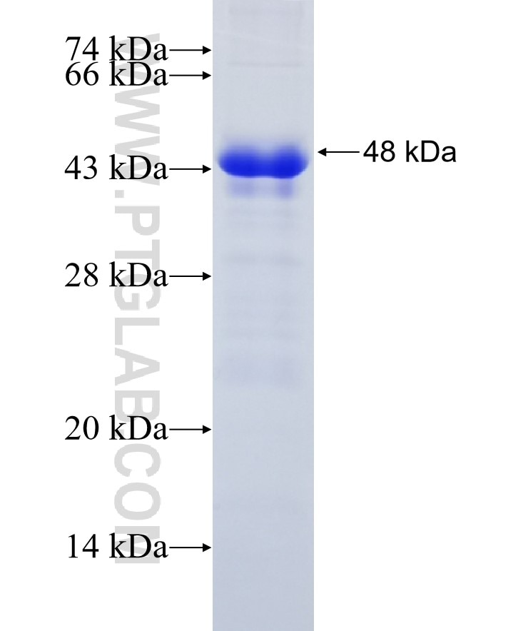 KIAA0586 fusion protein Ag19813 SDS-PAGE