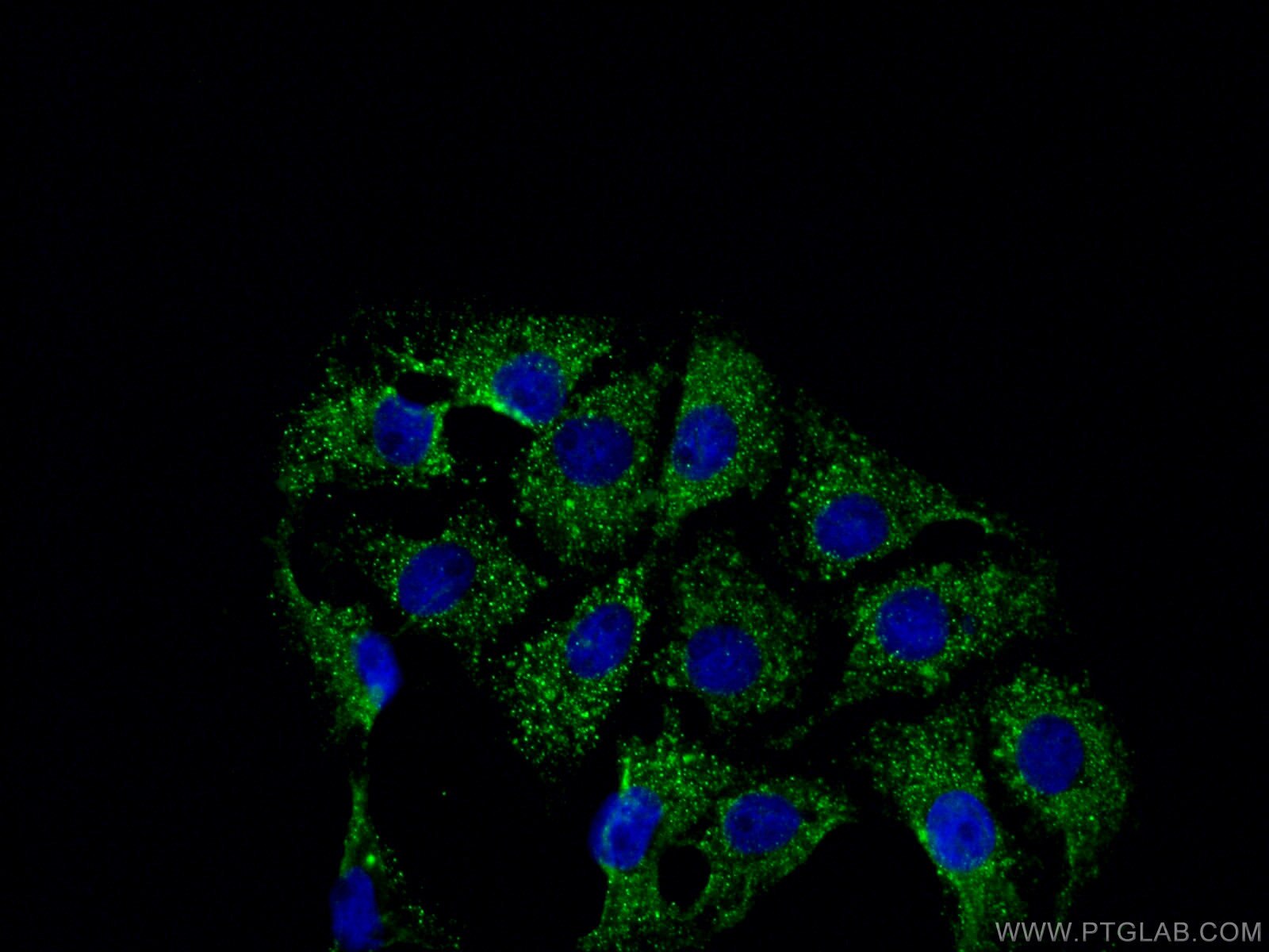 Immunofluorescence (IF) / fluorescent staining of SH-SY5Y cells using ATG13 Polyclonal antibody (18258-1-AP)