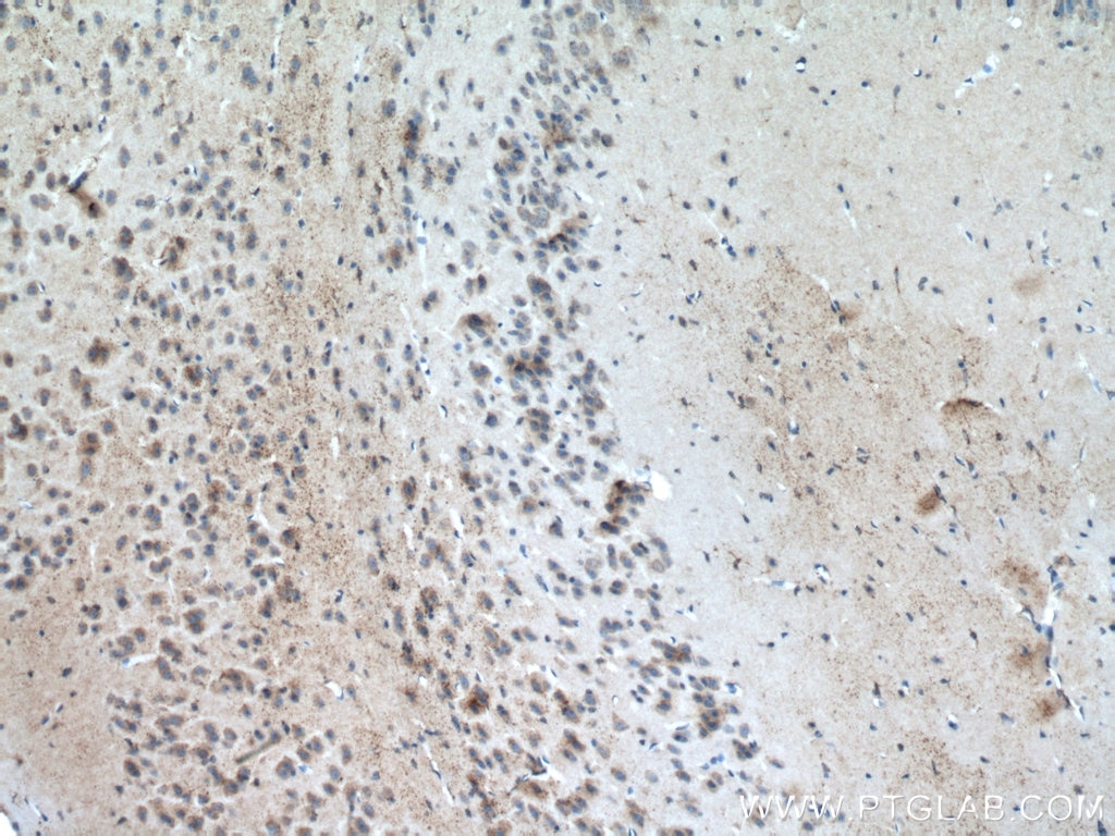 Immunohistochemistry (IHC) staining of mouse brain tissue using ATG13 Polyclonal antibody (18258-1-AP)