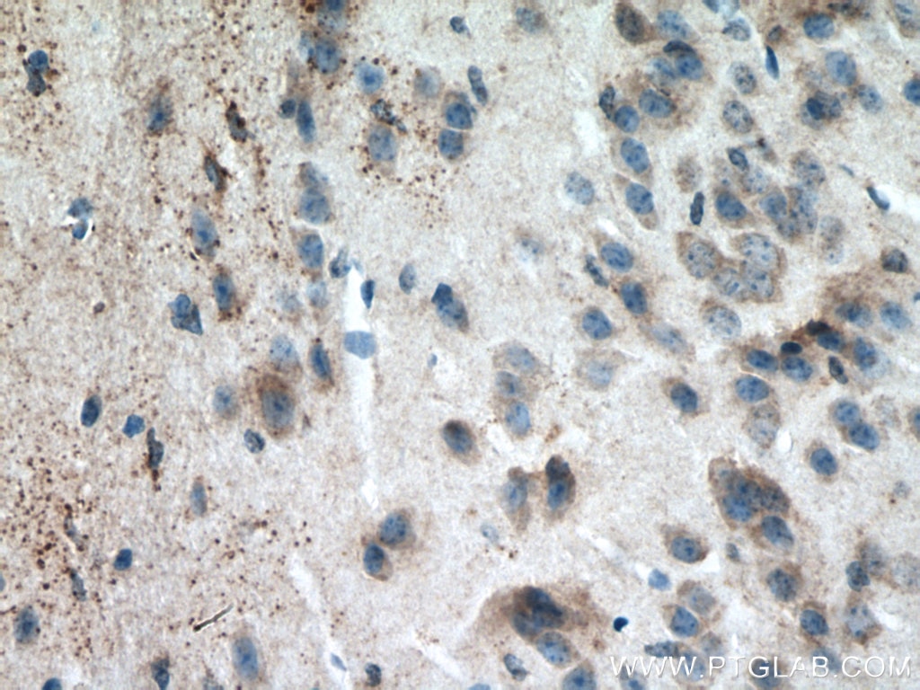 IHC staining of mouse brain using 18258-1-AP