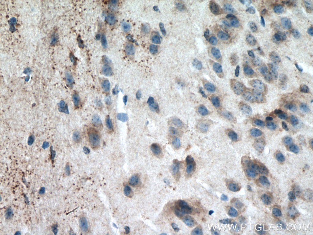 Immunohistochemistry (IHC) staining of mouse brain tissue using ATG13 Polyclonal antibody (18258-1-AP)