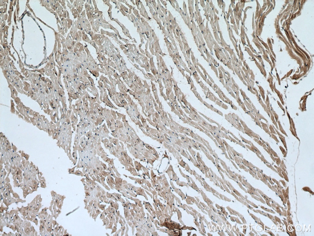 IHC staining of mouse heart using 18258-1-AP