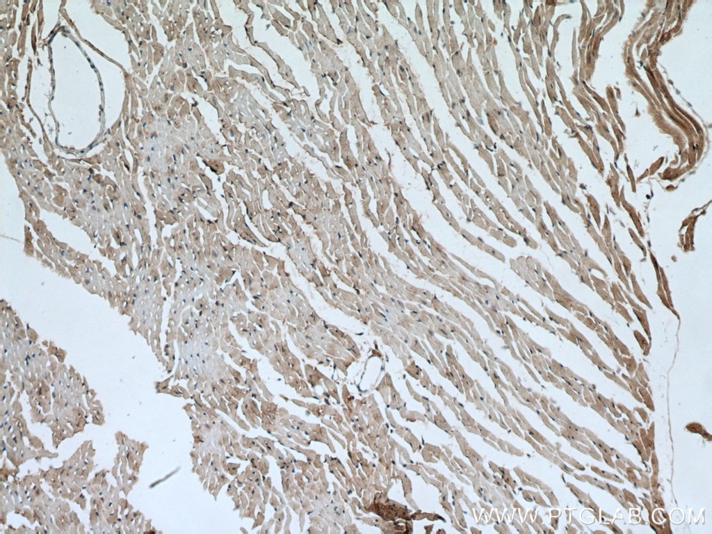 Immunohistochemistry (IHC) staining of mouse heart tissue using ATG13 Polyclonal antibody (18258-1-AP)