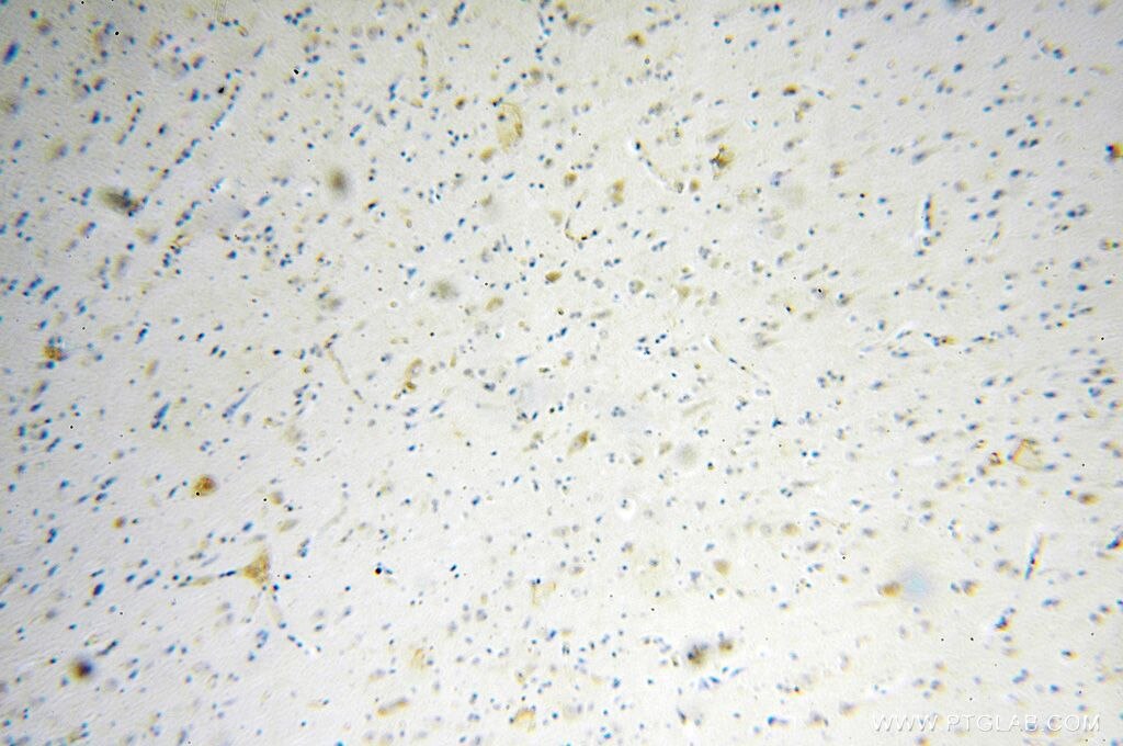 IHC staining of human brain using 18258-1-AP