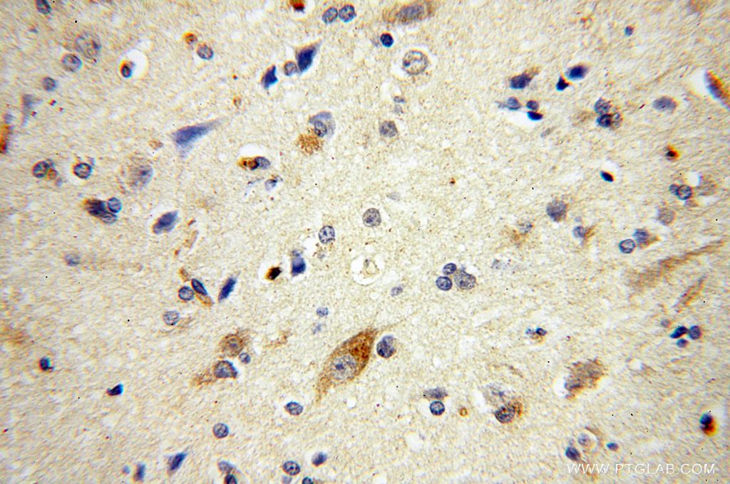 Immunohistochemistry (IHC) staining of human brain tissue using ATG13 Polyclonal antibody (18258-1-AP)