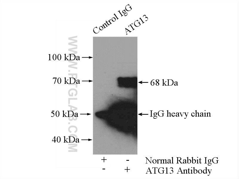 Immunoprecipitation (IP) experiment of SH-SY5Y cells using ATG13 Polyclonal antibody (18258-1-AP)